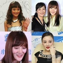 整容变明星,从平凡到璀璨明星的整容之路  第2张