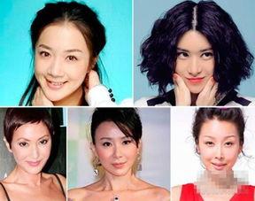 整容变明星,从平凡到璀璨明星的整容之路  第3张